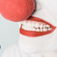 blanqueamiento dental casero-riesgos blanqueamiento dental casero-blanqueamiento dental-estética dental-clínica López Quevedo-dentistas Las Palmas-odontólogo Las Palmas-dentistas Las Palmas