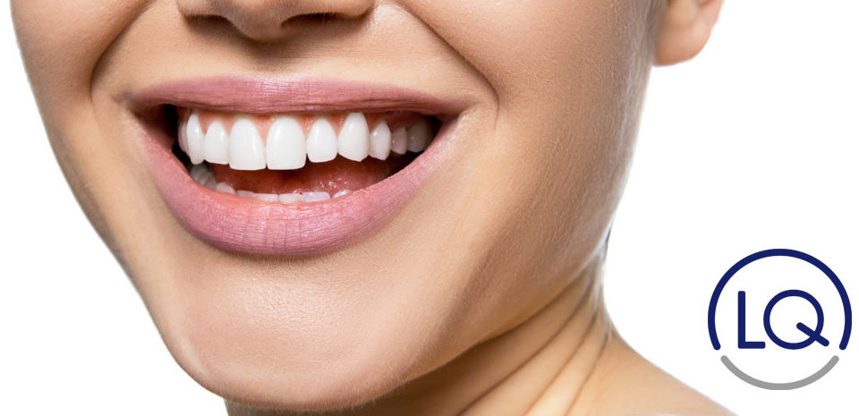 carillas dentales las palmas-dentistas en las palmas-odontologos en las palmas-lq clinica lopez quevedo-